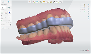 3shape scanner (TRIOS 3)