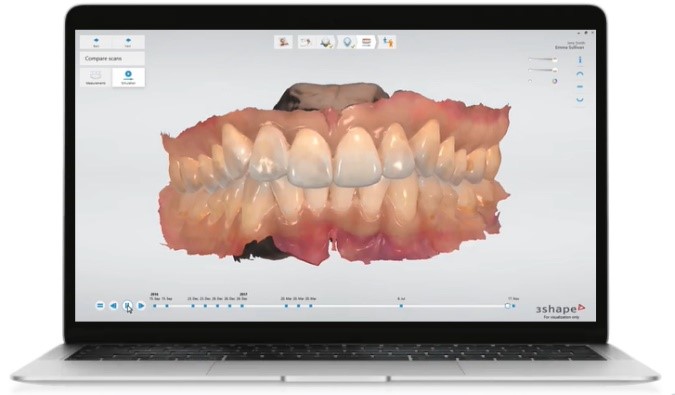 3shape scanner (TRIOS 3)