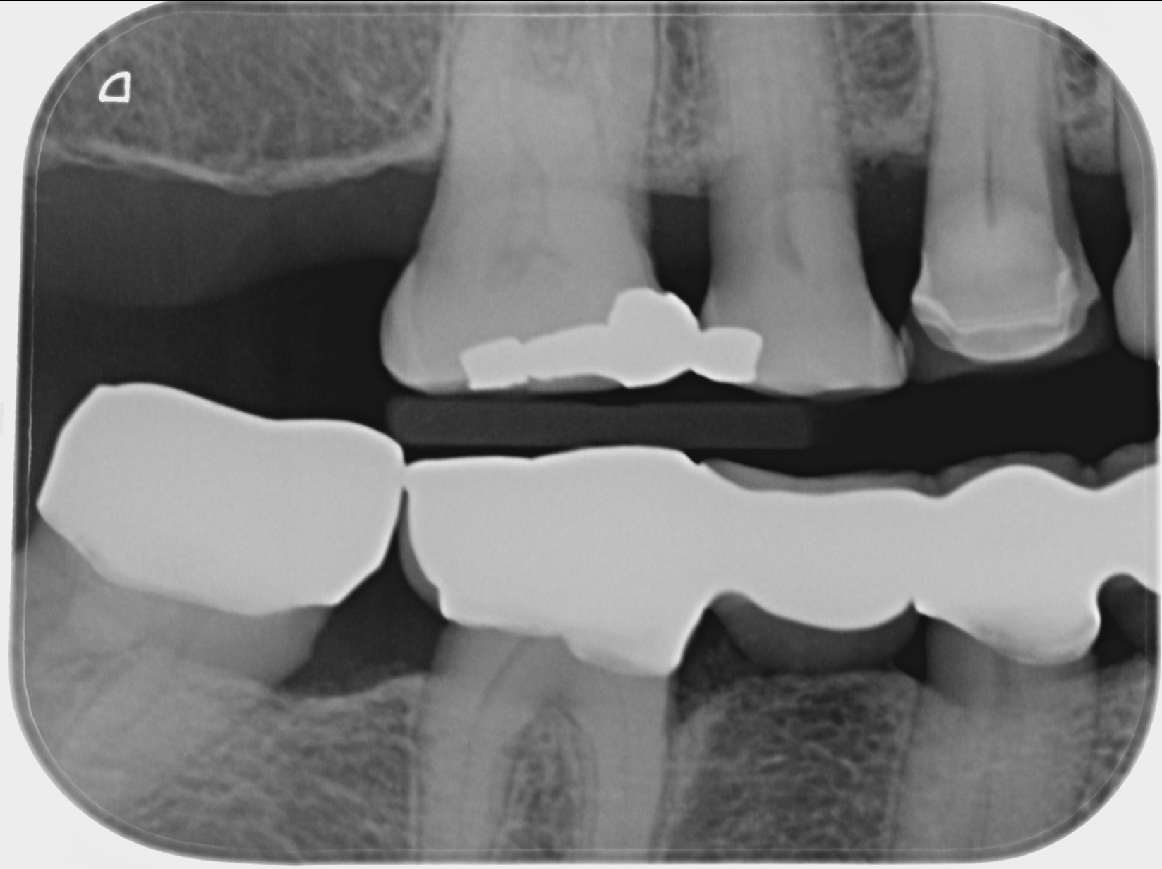 Asahi Intraoral x-ray