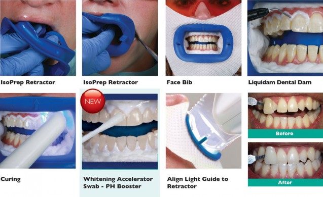 Philip Zoom Whitening