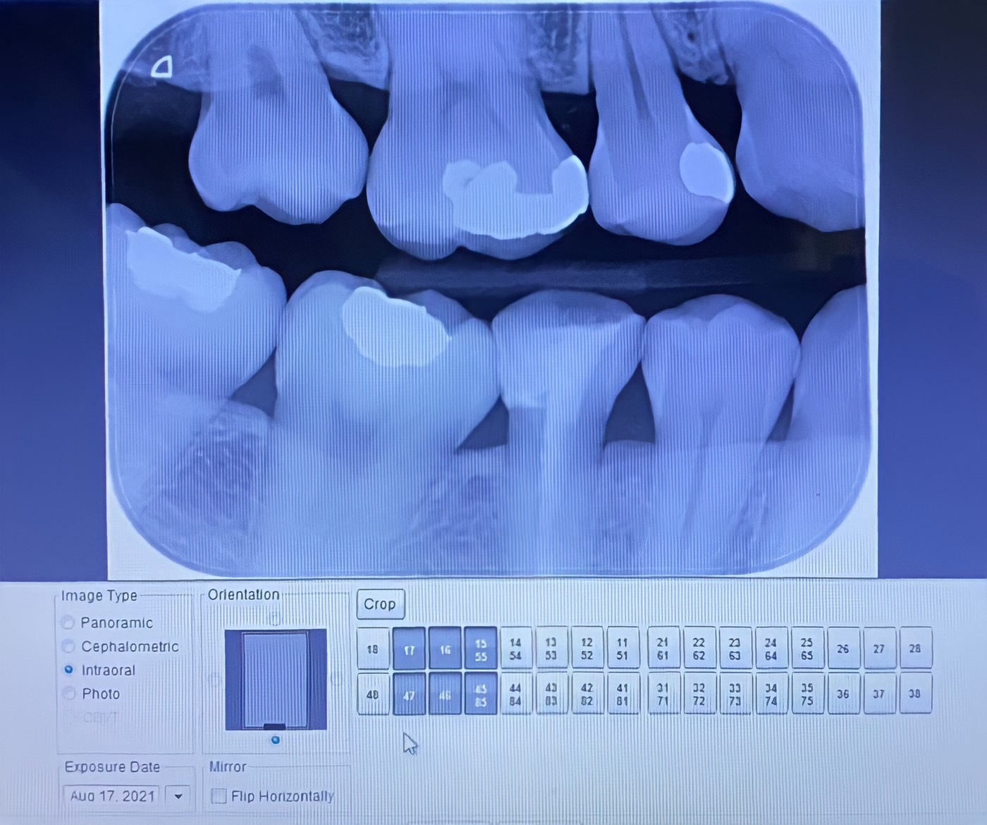 Image plate scanner