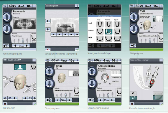 Planmeca Proline XC Digital X-ray