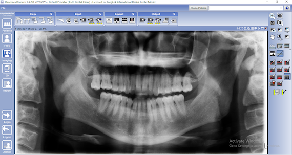 Planmeca Proline XC Digital X-ray