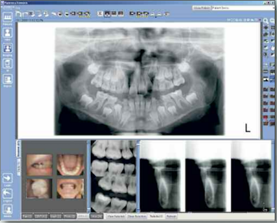 Planmeca Proline XC Digital X-ray