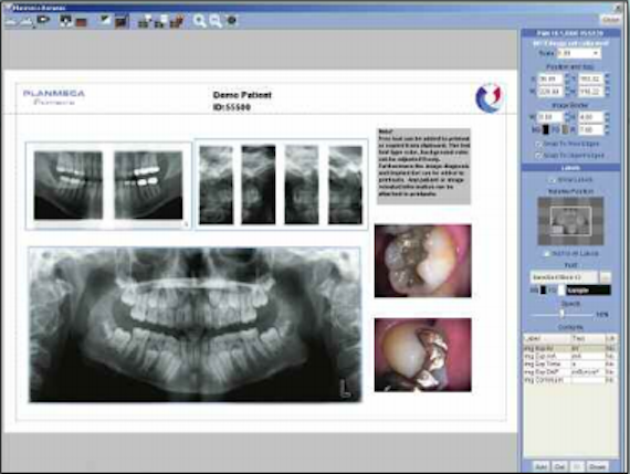 Planmeca Proline XC Digital X-ray