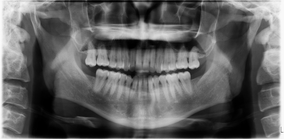 Planmeca Proline XC Digital X-ray